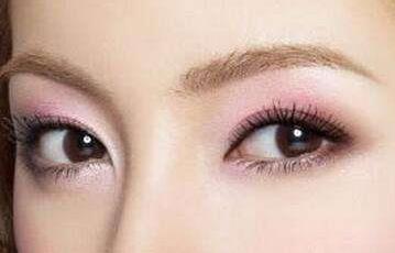 慈溪注射botox去魚(yú)尾紋醫(yī)生