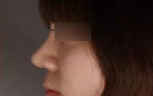 2023濟(jì)寧暢銷整形醫(yī)院匯總：抽脂技術(shù)亮眼，讓你輕松擁有完美身材！