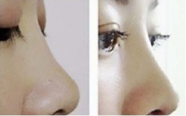 佛山top5家整形醫(yī)院評選