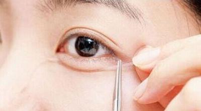 7月五家重慶有名氣的整形醫(yī)院優(yōu)惠價(jià)大比拼！整容專家曬出匯總單，誰(shuí)是冠軍？