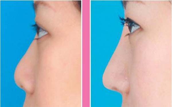 九院醫(yī)生推薦：無論是李青峰還是張余光，都是面部提升領(lǐng)域的頂尖專家！