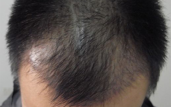 臨沂公立口腔醫(yī)院一覽：多家機(jī)構(gòu)備受贊譽(yù)，靠譜口碑讓您舉措輕松！確?？谇唤】?，快速選擇最佳！