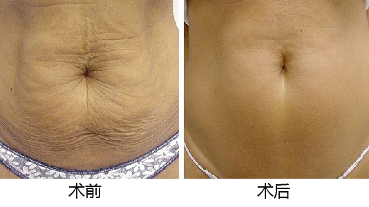 義烏整形醫(yī)院優(yōu)選TOP5，專業(yè)權(quán)威推薦，如何做出準(zhǔn)確選擇？深入了解為上策