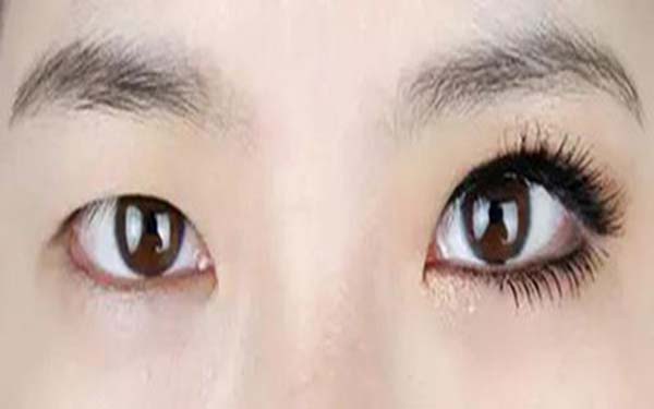 樂山整形醫(yī)院推薦：達芬奇與西嬋，你更喜歡哪一個？獲取比較結(jié)果！