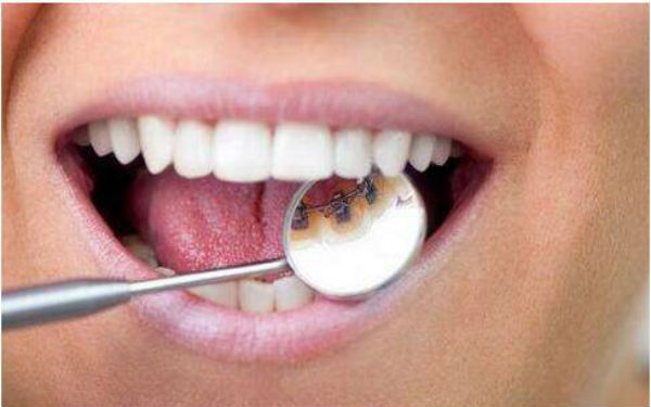 長(zhǎng)沙下巴后縮正畸醫(yī)生