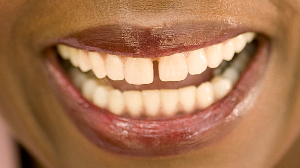 唐山手術(shù)消除細紋醫(yī)生