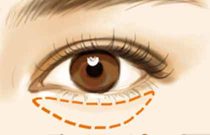 東莞腋臭頑疾攻略！五家治療效果突出的醫(yī)院排行榜出爐