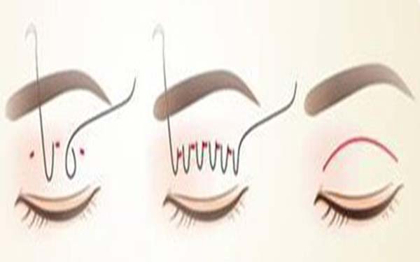 臨沂市七家頂級整形美容醫(yī)院推薦，祛斑護(hù)膚新方法揭秘