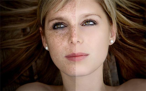 青島玻尿酸祛痘印醫(yī)生