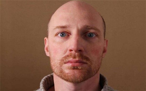 【攻略曝光】五大領(lǐng)軍品牌揭秘！尋找武漢最佳牙齒矯正所在的熱門名單