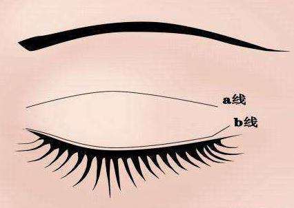 令人眼前一亮！遂寧多家雙眼皮整形醫(yī)院盤點，推薦陽光、伊莎貝拉等知名品牌，一起來了解吧