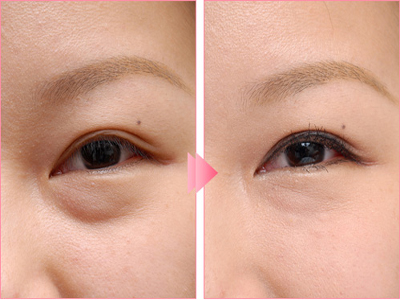 上海整形醫(yī)院最佳選擇！潔銘、伊萊美、時光、藝星等實力醫(yī)院推薦！