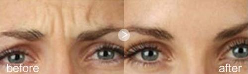 北京手指整形手術(shù)醫(yī)院推薦：頂尖機(jī)構(gòu)全覆蓋，你的理想之選