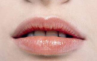 南京嗨體下巴注射醫(yī)生