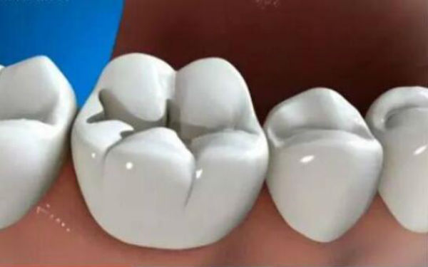 南京口腔醫(yī)院大全：一個問題解決口腔的終極名單！