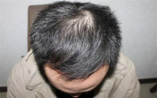 南昌三甲醫(yī)院全面盤點(diǎn)：專業(yè)美容整形醫(yī)院推薦，趕緊了解一下！