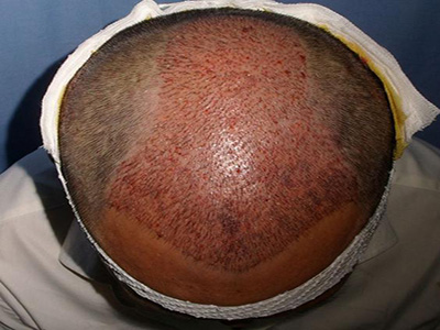 南通最佳祛斑醫(yī)院推薦！康美醫(yī)療第二，維多利亞給力薦！