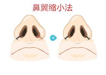 北京十大優(yōu)質(zhì)口腔醫(yī)院推薦，佳美第三醫(yī)院備受贊譽(yù)！中諾榜之精選參考