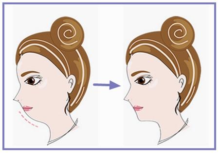 蘭州整形醫(yī)院排行榜出爐！選擇最滿意的吸脂抽脂醫(yī)院！