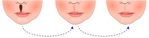 北京種植牙專家團(tuán)隊(duì)超卓，醫(yī)院名列前茅！