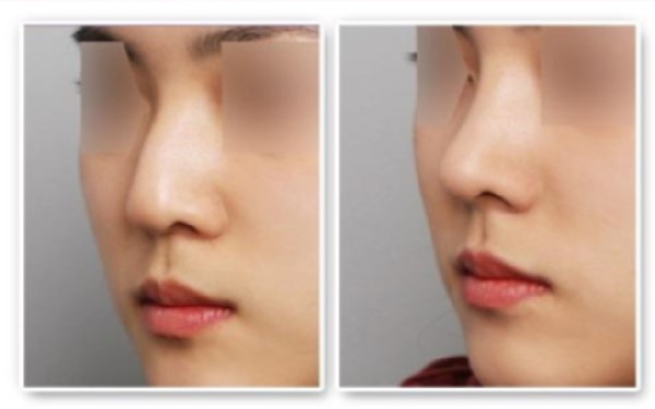 南京紋身去除醫(yī)院大全：幫助您恢復光滑肌膚的專業(yè)機構！