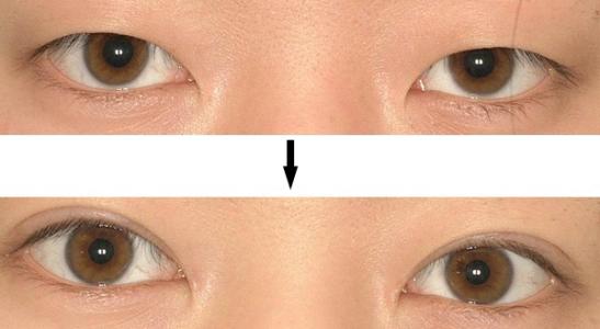 廈門哪家三甲整形醫(yī)院口碑最好？大揭秘，公立還是私立更值得信賴！