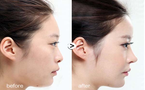 北京眼袋手術(shù)醫(yī)院匯總：前五強(qiáng)推薦，不容錯(cuò)過(guò)！