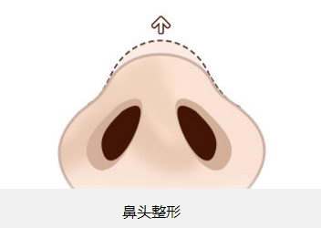 北京植眉醫(yī)院推薦：高新及新生，專業(yè)醫(yī)護技藝令人贊嘆！