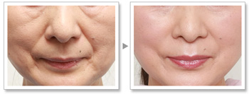 南充皮膚修復(fù)中心：精心挑選的6家洗紋身醫(yī)院，達(dá)芬奇、韓美榜上集結(jié)