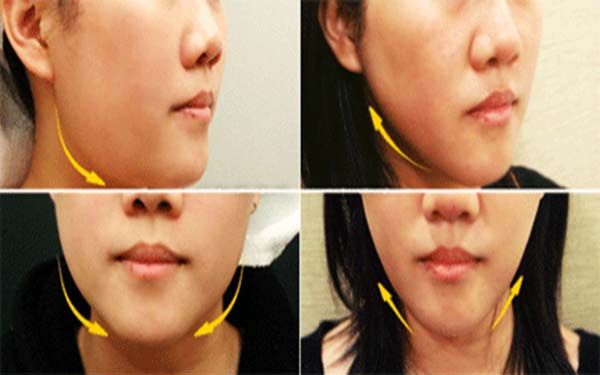 烏魯木齊除皺針祛下眼皮皺紋醫(yī)生