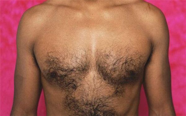 北京哪家醫(yī)院祛斑效果最好？匯總5家頂級醫(yī)院供參考！附最新價目表揭曉！