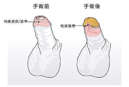 南京哪家醫(yī)院矯正牙齒比較好？推薦貝鶴雅康、美奧、貝芽、卡瓦、藍鱘等！