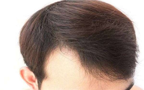 廣州整形醫(yī)院綜合指南：不可錯(cuò)過的醫(yī)美中心全解析！