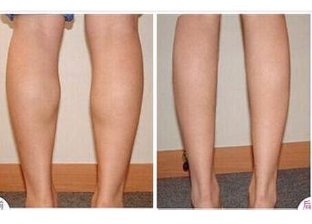 廣州脫發(fā)醫(yī)院排行榜：這些醫(yī)療機構讓你恢復美麗發(fā)際線！