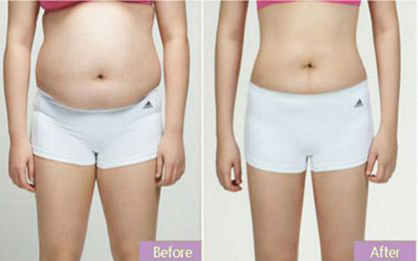 常德眼袋手術(shù)推薦排名TOP10！公私醫(yī)院詳細(xì)對比，看看你選對了沒有