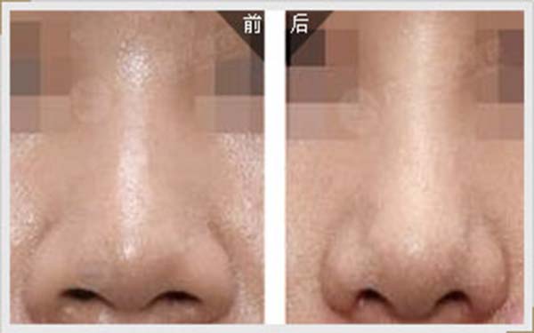 濟(jì)南私密年輕化醫(yī)生