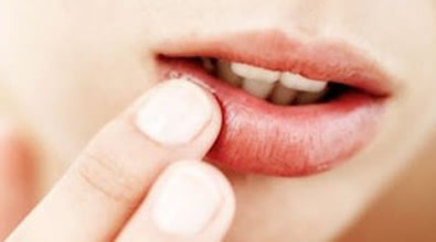 湖南co2點陣激光祛斑醫(yī)生