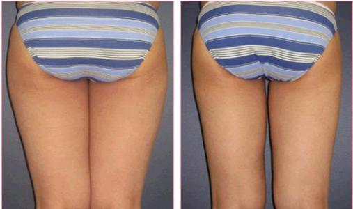 天津治療疤痕疙瘩醫(yī)院排行榜：文怡、坤如瑪麗引人矚目！