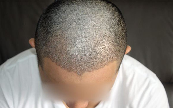 四川首屈一指的美容整形醫(yī)院排名前四！川內(nèi)必看整形醫(yī)院詳細攻略