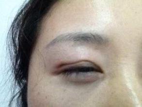 廣州隆鼻手術(shù)：挑選最好的醫(yī)生，口碑盤點！是否有你最滿意的專家？