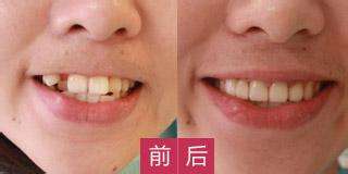 哪家醫(yī)院適合進行磨骨手術(shù)？江城和美立方廣受網(wǎng)友推崇！