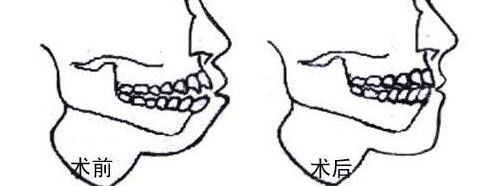 太原祛疤醫(yī)院推薦：多家專業(yè)機構(gòu)為您帶來有效祛疤方案!