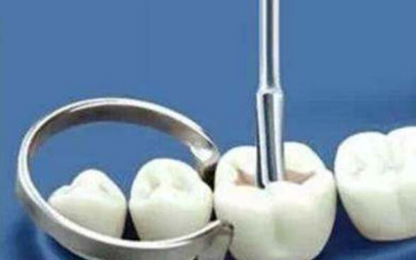 廣州四位頂級鼻整形醫(yī)師，專業(yè)實(shí)力卓越、獨(dú)具匠心