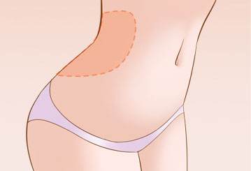 呼市哪家醫(yī)院最受歡迎？雙眼皮效果超過80%的用戶推薦！