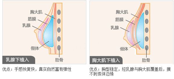 宜賓最佳雙眼皮整形醫(yī)院推薦！這七家美容院你絕不能錯(cuò)過