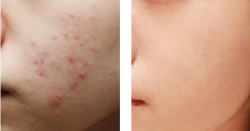 周口地區(qū)知名整形醫(yī)院推薦，精選醫(yī)療機構已可查詢