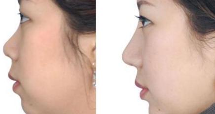 國(guó)內(nèi)十佳疤痕治療醫(yī)院評(píng)選結(jié)果曝光：公立醫(yī)院對(duì)私立醫(yī)院PK！