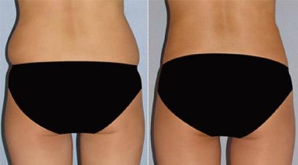 成都最受好評(píng)的整形醫(yī)院匯總，專業(yè)拉皮手術(shù)效果一流