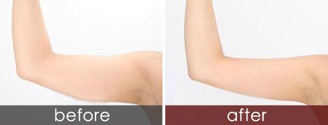 成都整形醫(yī)院排行榜揭曉！四川嬌點(diǎn)、八大處嶄露頭角，哪家奪得前三？