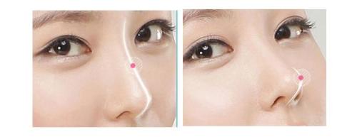 揭秘西安豐胸三甲醫(yī)院專家評選！西京、唐都脫穎而出，實(shí)力堪比五強(qiáng)！